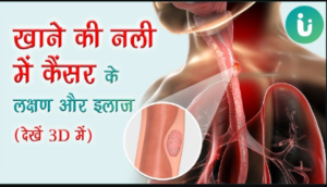 breast me pain ke reason in hindi