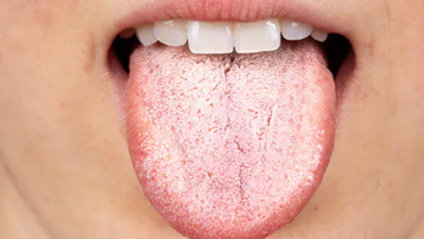 Tongue Health: Do Good & Bad Bacteria Taste Differently?
