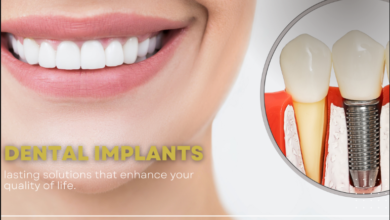 Investing in Your Smile: The Long-Term Benefits of Dental Implants