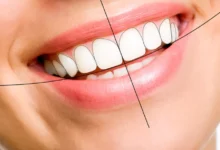 Dental Aesthetics to Improve Your Smile